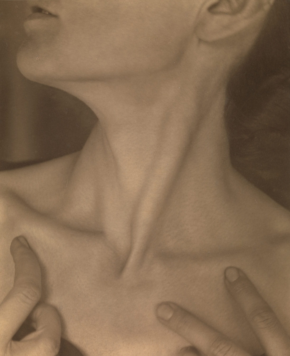 Fig. 8. Photograph of triangular musculature at the base of the neck. 